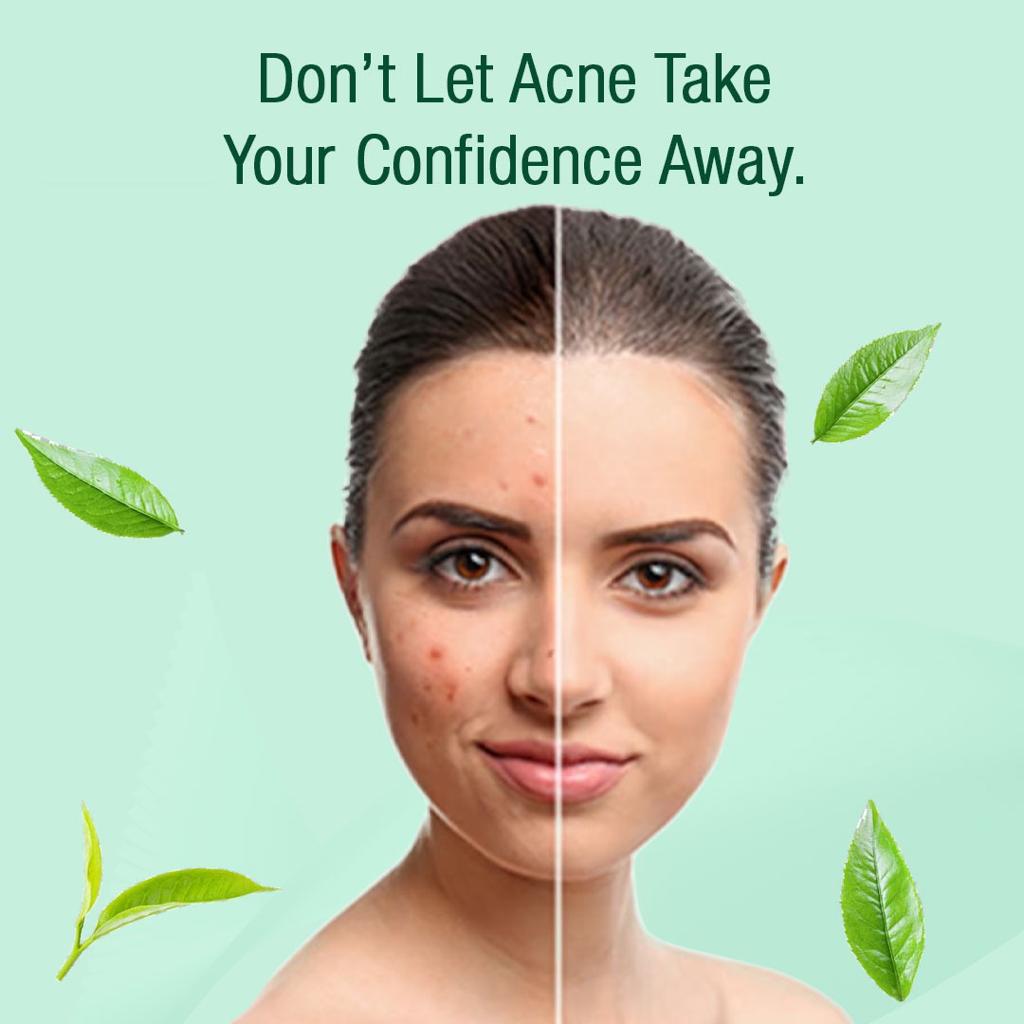 Orangewood Professional Acne Shield Facial Kit ( Anti-acne) - 58gm